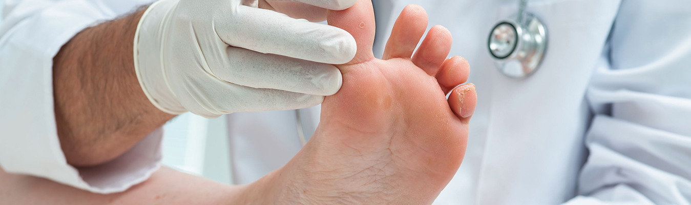 Amniotic Band Syndrome - Chicago Foot Care Clinic